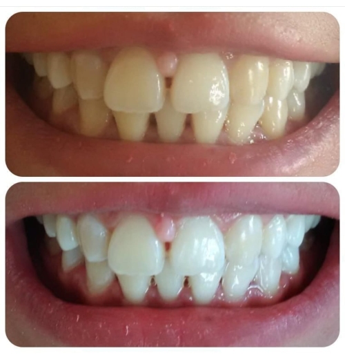 Rekomendasi Pasang Kawat Gigi Terdekat Sanafa Dental Clinic