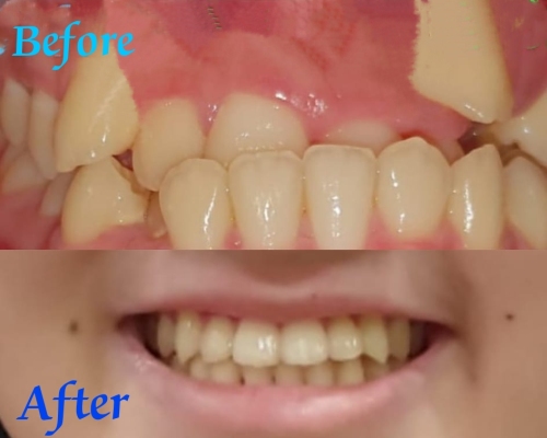 Rekomendasi Klink Dokter Gigi Profesional Sanafa Dental Clinic