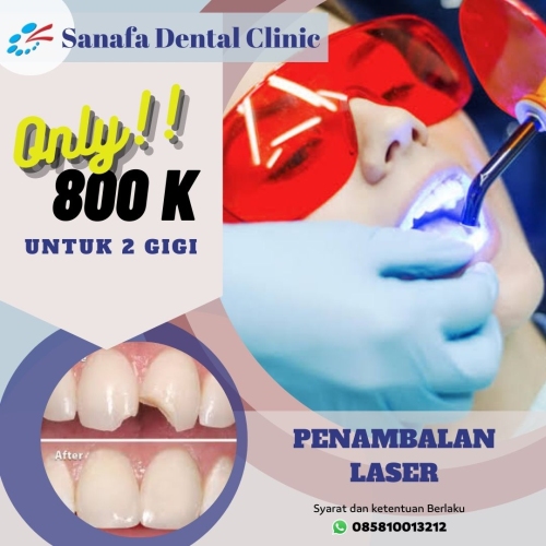 Rekomendasi Perawatan Gigi Anak Termurah Sanafa Dental Clinic